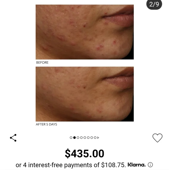 Dr.Gross light mask - Picture 2 of 2